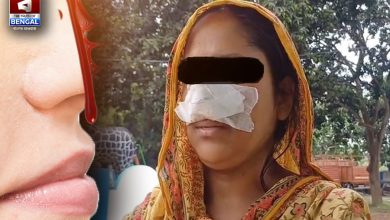 Husband bites wife's nose! Strange incident witnessed in Shantipur
