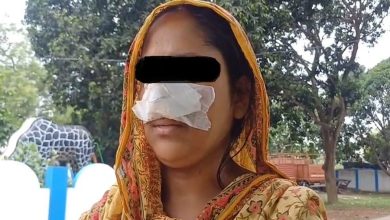 Husband bites wife's nose! Strange incident witnessed in Shantipur