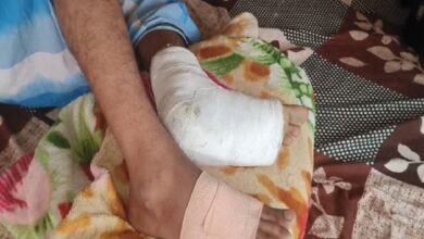 haryana-police-breaks-leg-of-bengali-worker-administration
