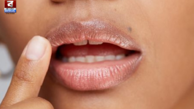 lip discoloration